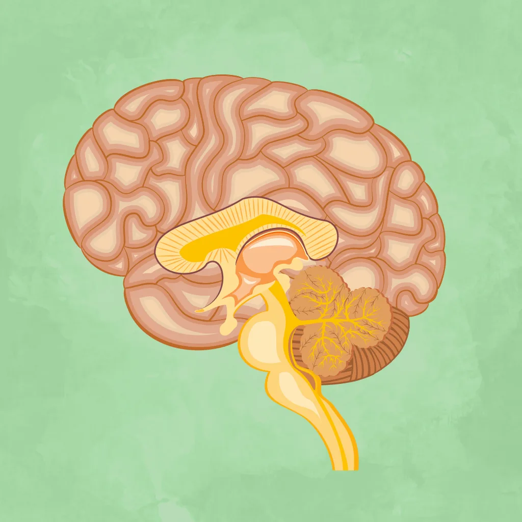 Migraine