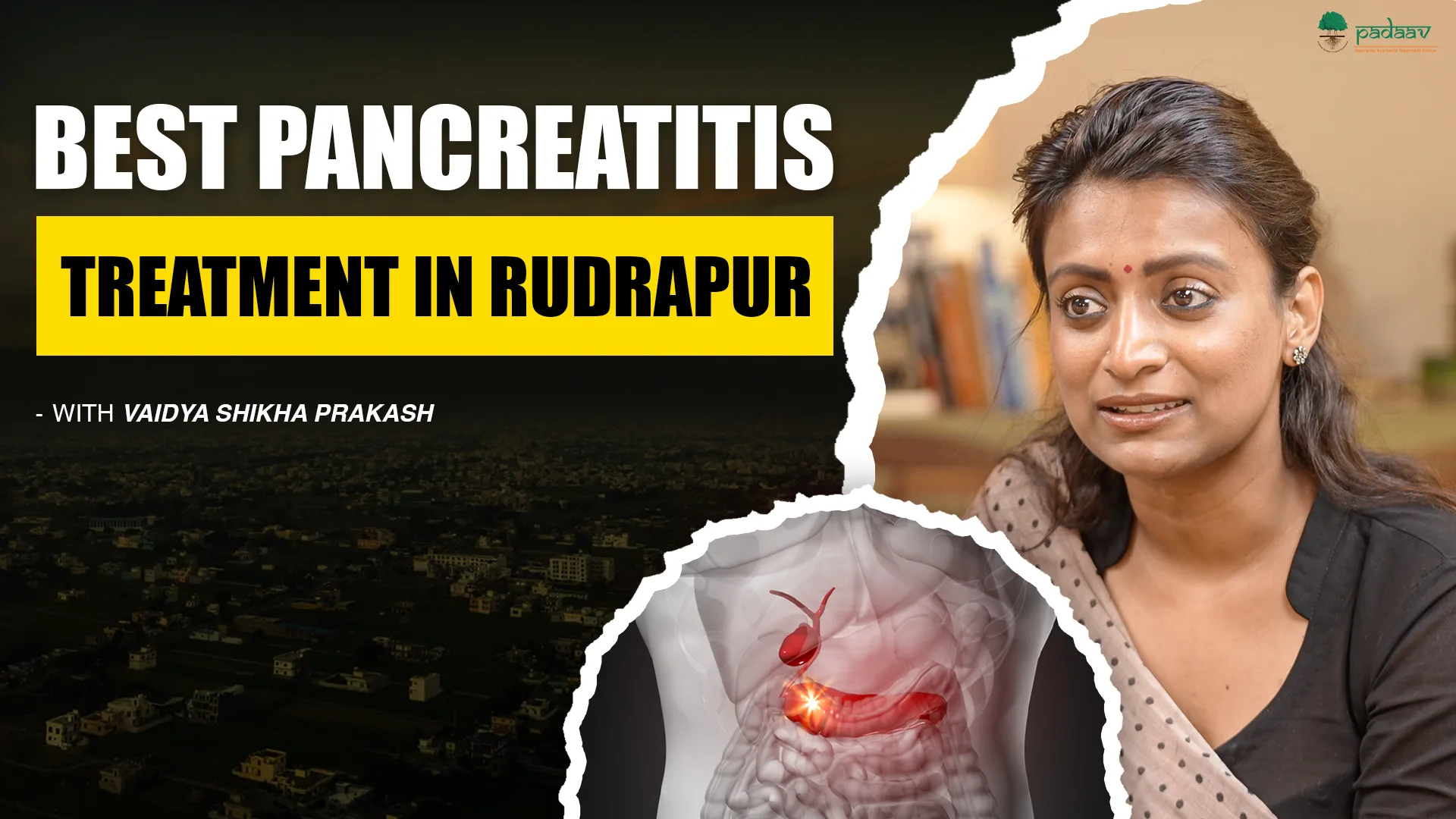 Specialized Pancreatitis Treatment in Rudrapur: Padaav Ayurveda’s Clinically Proven Protocol